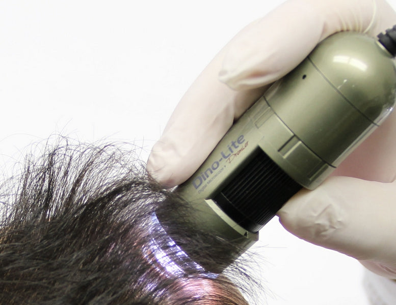 TrichoScope Polarizer Dino Lite MEDL4HM (tricoscopio)