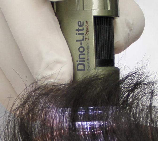 TrichoScope Polarizer Dino Lite MEDL4HM (tricoscopio)