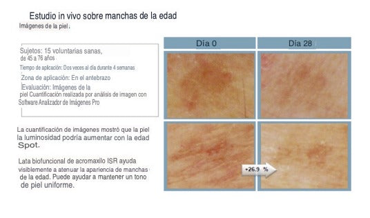MAX WHITE crema antimanchas